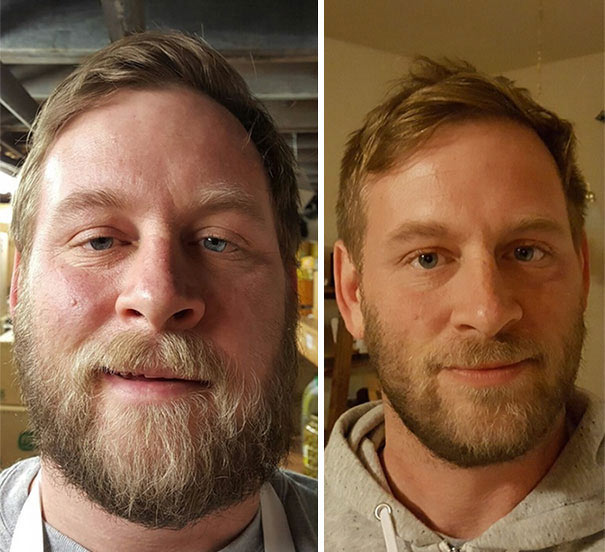 Фотографии людей до и после того, как они бросили пить