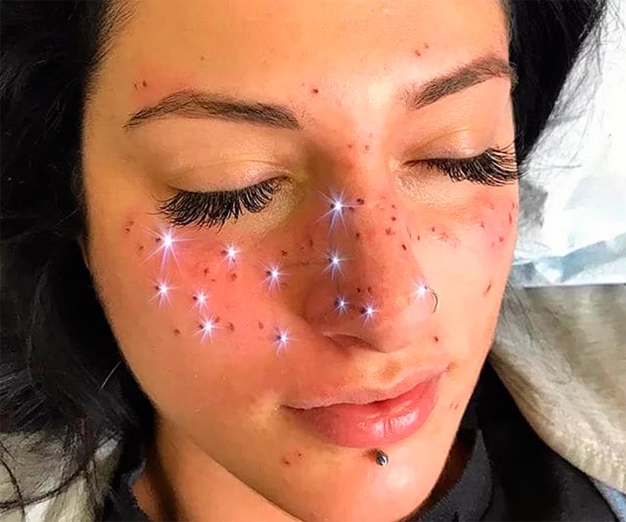 астровеснушки astro freckles